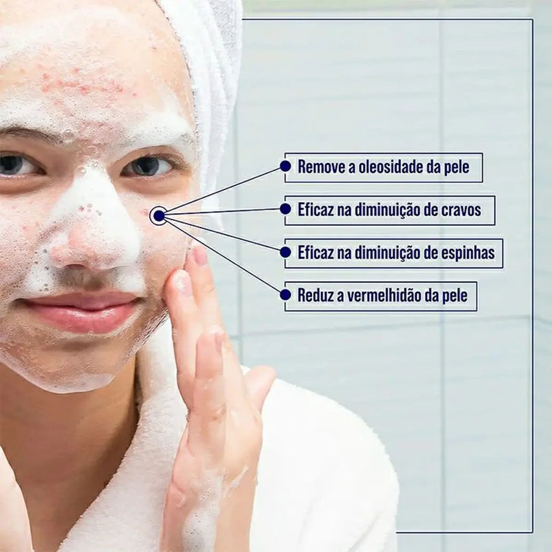 Sabonete Facial Antiacne